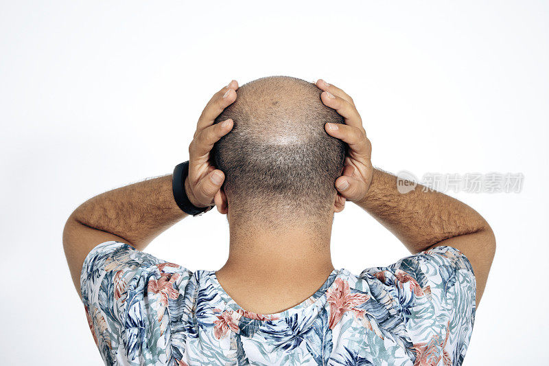 Back of the young man's bald head